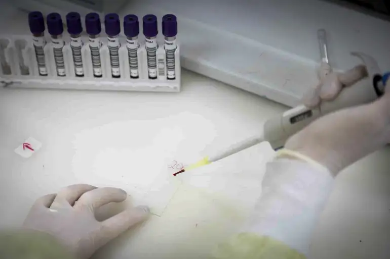 Exames descartam ebola em imigrante da República Democrática do Congo